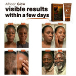 Anti-Dark Spot & Acne African Black Kit